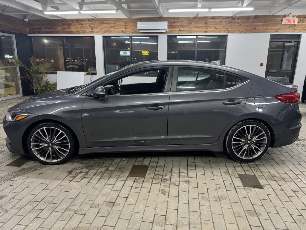 2018 Hyundai Elantra Sport